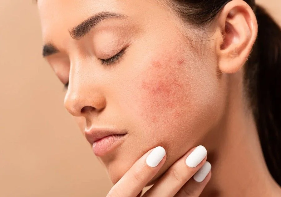 Kem dưỡng thể bôi mặt được không